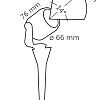 in-lite Big Scope Narrow